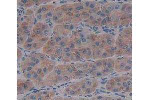 IHC-P analysis of liver tissue, with DAB staining. (ADAMTS13 Antikörper  (AA 896-1131))