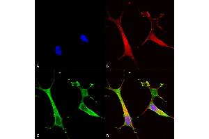Immunocytochemistry/Immunofluorescence analysis using Mouse Anti-Copper Transporting ATPase 2 Monoclonal Antibody, Clone S62-29 (ABIN2485175). (ATP7B Antikörper  (AA 3-21) (FITC))