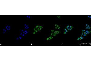 Immunocytochemistry/Immunofluorescence analysis using Rabbit Anti-p53 Polyclonal Antibody . (p53 Antikörper  (C-Term) (PerCP))