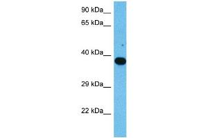 Western Blotting (WB) image for anti-Nuclear Factor of kappa Light Polypeptide Gene Enhancer in B-Cells Inhibitor, epsilon (NFKBIE) (Middle Region) antibody (ABIN2780607)