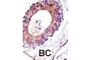 Immunohistochemistry (IHC) image for anti-Ubiquitination Factor E4A (UBE4A) antibody (ABIN3001447) (UBE4A Antikörper)