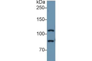 Detection of TLR5 in Human A549 cell lysate using Polyclonal Antibody to Toll Like Receptor 5 (TLR5) (TLR5 Antikörper  (AA 693-858))