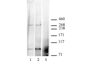 CABIN1 antibody (pAb) tested by Immunoprecipitation / Western blot. (CABIN1 Antikörper  (C-Term))