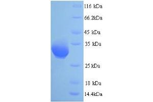 SDS-PAGE (SDS) image for Heterogeneous Nuclear Ribonucleoprotein A2/B1 (HNRNPA2B1) (AA 1-249), (full length) protein (His tag) (ABIN5713506)