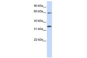 RHOT1 antibody used at 1 ug/ml to detect target protein. (RHOT1 Antikörper  (Middle Region))