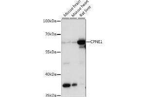 Western blot analysis of extracts of various cell lines, using CPNE1 antibody (ABIN7266499) at 1:1000 dilution. (CPNE1 Antikörper  (AA 120-220))