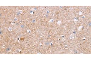 Immunohistochemistry of paraffin-embedded Human brain tissue using CDC7 Polyclonal Antibody at dilution 1:50