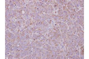 IHC-P Image MAGEB1 antibody detects MAGEB1 protein at cytosol on MCF-7 xenograft by immunohistochemical analysis. (MAGEB1 Antikörper  (Center))