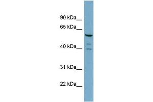 WB Suggested Anti-RABGEF1  Antibody Titration: 0. (RABGEF1 Antikörper  (N-Term))