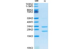 MASP2 Protein (AA 287-686) (His tag)