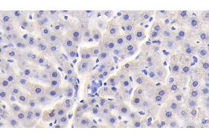 Detection of vHL in Rat Liver Tissue using Polyclonal Antibody to Von Hippel Lindau Tumor Suppressor (vHL) (VHL Antikörper  (AA 6-175))