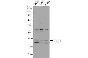 WB Image SUGT1 antibody detects SUGT1 protein by western blot analysis.