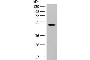 Western blot analysis of Hela cell lysate using GPR142 Polyclonal Antibody at dilution of 1:400 (GPR142 Antikörper)