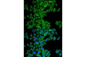 Immunofluorescence analysis of MCF-7 cell using DIABLO antibody. (DIABLO Antikörper  (AA 1-232))