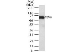 Image no. 1 for anti-anthrax Toxin Receptor 1 (ANTXR1) (AA 481-497) antibody (ABIN208216) (ANTXR1 Antikörper  (AA 481-497))
