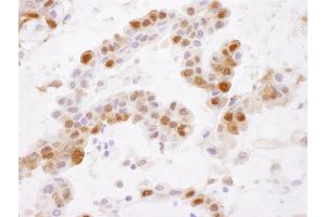 Immunohistochemistry (IHC) image for anti-Glutathione S-Transferase pi 1 (GSTP1) (AA 160-210) antibody (ABIN7453941) (GSTP1 Antikörper  (AA 160-210))