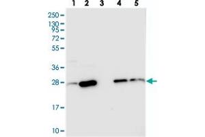 Western blot analysis of Lane 1: RT-4, Lane 2: U-251 MG, Lane 3: Human Plasma, Lane 4: Liver, Lane 5: Tonsil with CRIP2 polyclonal antibody  at 1:250-1:500 dilution. (CRIP2 Antikörper)