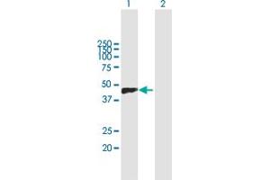 Western Blot analysis of VCAN expression in transfected 293T cell line by VCAN MaxPab polyclonal antibody.
