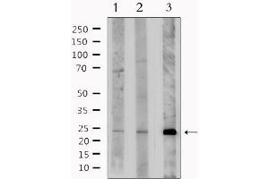 Western blot analysis of extracts from various samples, using BNIP3L Antibody. (BNIP3L/NIX Antikörper  (Internal Region))