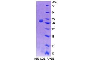 SDS-PAGE analysis of Mouse TCEA2 Protein.