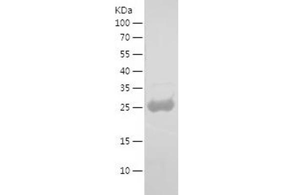 CD9 Protein (CD9) (AA 133-363) (His tag)