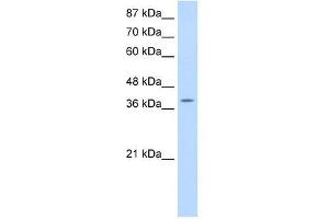 MYST4 antibody used at 0.