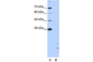 WB Suggested Anti-PPIE  Antibody Titration: 2.