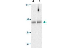 Western blot analysis of HTRA2 in human colon cell lysates with HTRA2 polyclonal antibody  at (A) 0. (HTRA2 Antikörper  (C-Term))