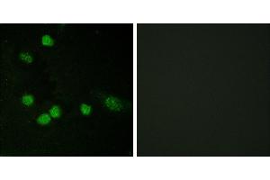 Peptide - +Immunofluorescence analysis of HeLa cells, using Raf1 (Ab-621) antibody. (RAF1 Antikörper  (Ser621))