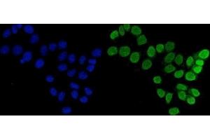 IF analysis of FEN1 using anti-FEN1 antibody (ABIN7601618). (FEN1 Antikörper  (AA 4-300))