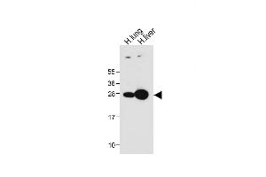 All lanes : Anti-GSTM4 Antibody (N-term) at 1:1000 dilution Lane 1: Human lung tissue lysate Lane 2: Human liver tissue lysate Lysates/proteins at 20 μg per lane. (GSTM4 Antikörper  (N-Term))