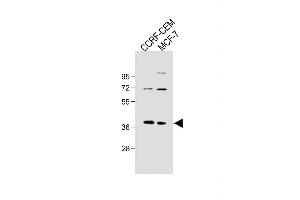 All lanes : Anti-OGN Antibody (N-term K75) at 1:500 dilution Lane 1: CCRF-CEM whole cell lysate Lane 2: MCF-7 whole cell lysate Lysates/proteins at 20 μg per lane. (OGN Antikörper  (C-Term))