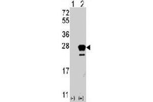 Western blot analysis of NRAS (arrow) using rabbit NRAS polyclonal antibody . (GTPase NRas Antikörper  (N-Term))