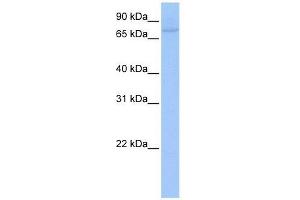 Western Blot showing ZNF440 antibody used at a concentration of 1-2 ug/ml to detect its target protein. (ZNF440 Antikörper  (C-Term))