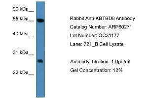 WB Suggested Anti-KBTBD8  Antibody Titration: 0. (KBTBD8 Antikörper  (N-Term))