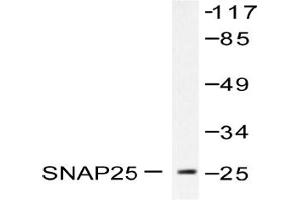 Image no. 1 for anti-Synaptosomal-Associated Protein, 25kDa (SNAP25) antibody (ABIN271818) (SNAP25 Antikörper)
