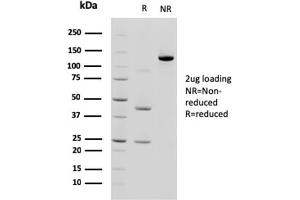 SDS-PAGE AnalysisPurified Cadherin 17 / CDH17 Mouse Monoclonal Antibody (CDH17/2618). (LI Cadherin Antikörper  (AA 242-418))