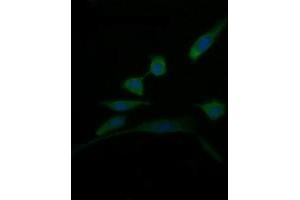Image no. 2 for anti-D-Dopachrome Tautomerase (DDT) antibody (ABIN1497794)