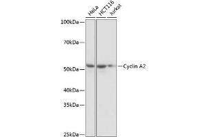 Western blot analysis of extracts of various cell lines, using Cyclin  antibody (ABIN7266551) at 1:1000 dilution. (Cyclin A Antikörper)