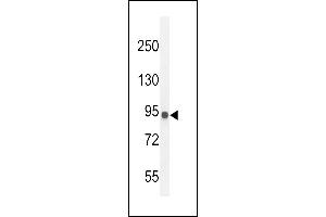 IL12RB2 Antibody (C-term) (ABIN654644 and ABIN2844340) western blot analysis in MDA-M cell line lysates (35 μg/lane). (IL12_2 (AA 756-783), (C-Term) Antikörper)