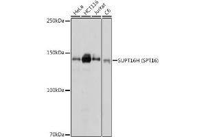 Western blot analysis of extracts of various cell lines, using SUPT16H (SPT16) antibody (ABIN7267097) at 1:1000 dilution. (SUPT16H Antikörper)