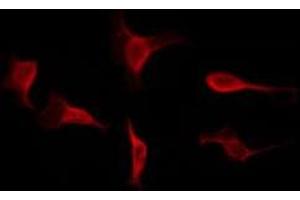 Immunofluorescence (fixed cells) (IF/ICC) image for anti-Heterogeneous Nuclear Ribonucleoprotein L (HNRNPL) (N-Term) antibody (ABIN6262324)