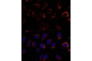 Immunofluorescence analysis of U-2 OS cells using S2 antibody (ABIN7265451) at dilution of 1:100. (AP3S2 Antikörper  (AA 1-193))