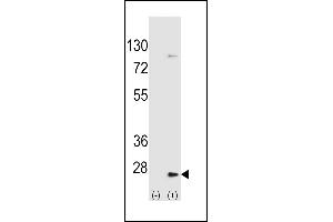 Western blot analysis of UBE2H (arrow) using rabbit polyclonal UBE2H Antibody  (ABIN650698 and ABIN2839162). (UBE2H Antikörper  (C-Term))