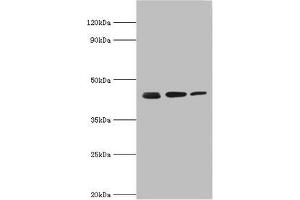 Western blot All lanes: Actin-related protein 2 antibody at 3 μg/mL Lane 1: Mouse spleen tissue Lane 2: Jurkat whole cell lysate Lane 3: MCF-7 whole cell lysate Secondary Goat polyclonal to rabbit IgG at 1/10000 dilution Predicted band size: 45, 46 kDa Observed band size: 45 kDa