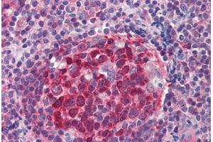 Human Tonsil (formalin-fixed, paraffin-embedded) stained with RRM2B antibody ABIN214469 at 2. (RRM2B Antikörper  (AA 2-17))