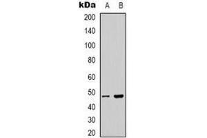 Western blot analysis of PSKH1 expression in Hela (A), HepG2 (B) whole cell lysates. (PSKH1 Antikörper)
