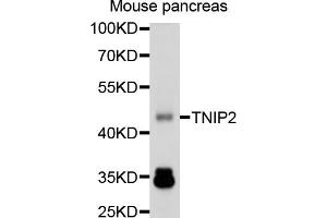 Western blot analysis of extracts of mouse pancreas, using TNIP2 antibody (ABIN1875145) at 1:1000 dilution. (TNIP2 Antikörper)