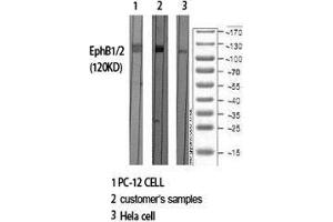 Western Blot (WB) analysis of specific cells using EphB1/2 Polyclonal Antibody. (EPHB1/2 Antikörper  (Ser10))