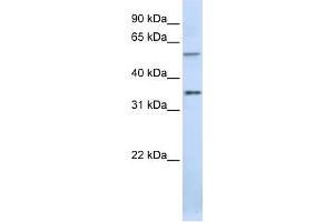 WB Suggested Anti-TJAP1 Antibody Titration:  0. (TJAP1 Antikörper  (C-Term))